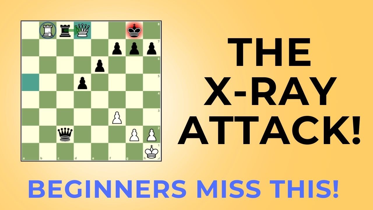 X‑Ray Tactics: The Secret Pattern Beginners Miss