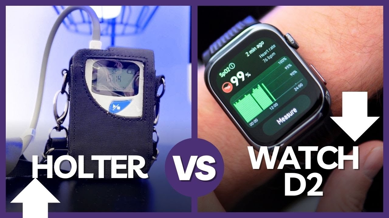 Profesjonalny Holter vs Huawei Watch D2 - PORÓWNANIE Wyników - TEST Opinie - Mobileo [PL]