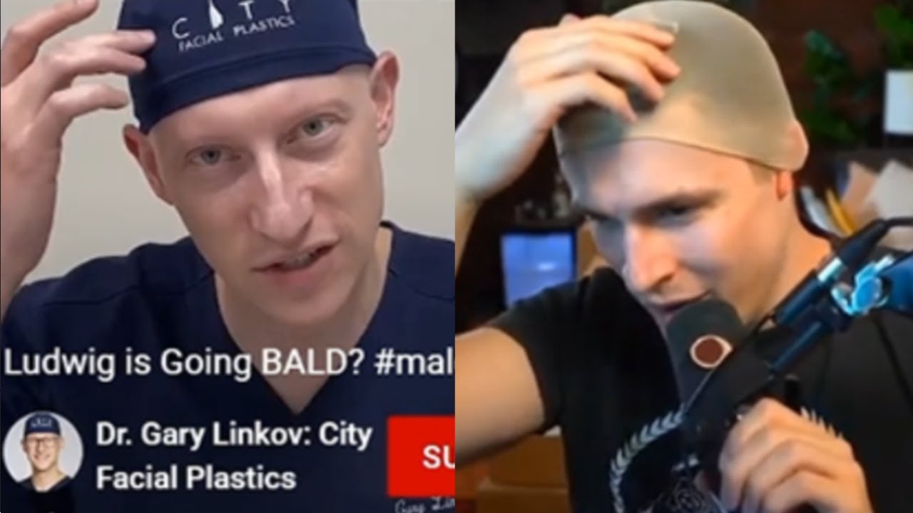 Doctor confirms Ludwig is balding