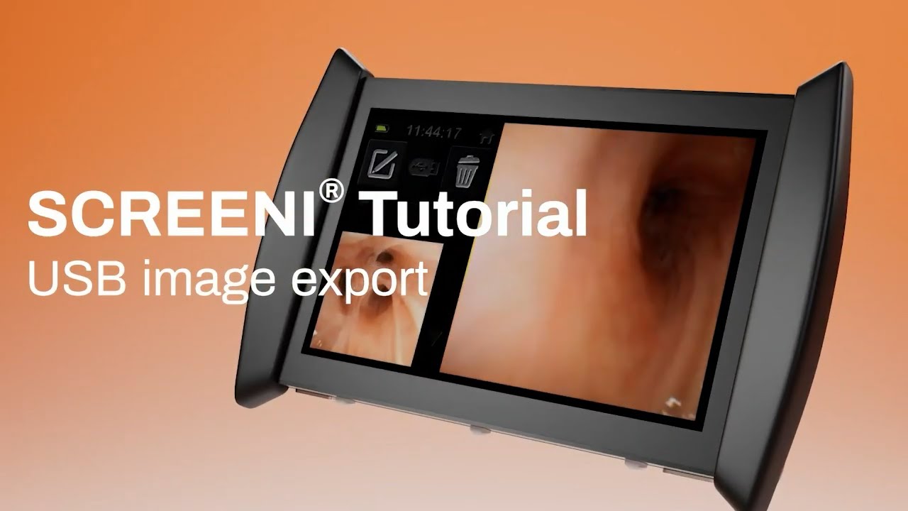 Screeni® – How to Export Images and Videos from the Screeni System via USB