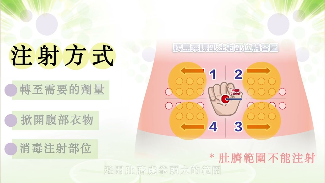 糖德仕胰島素注射技巧(國語)