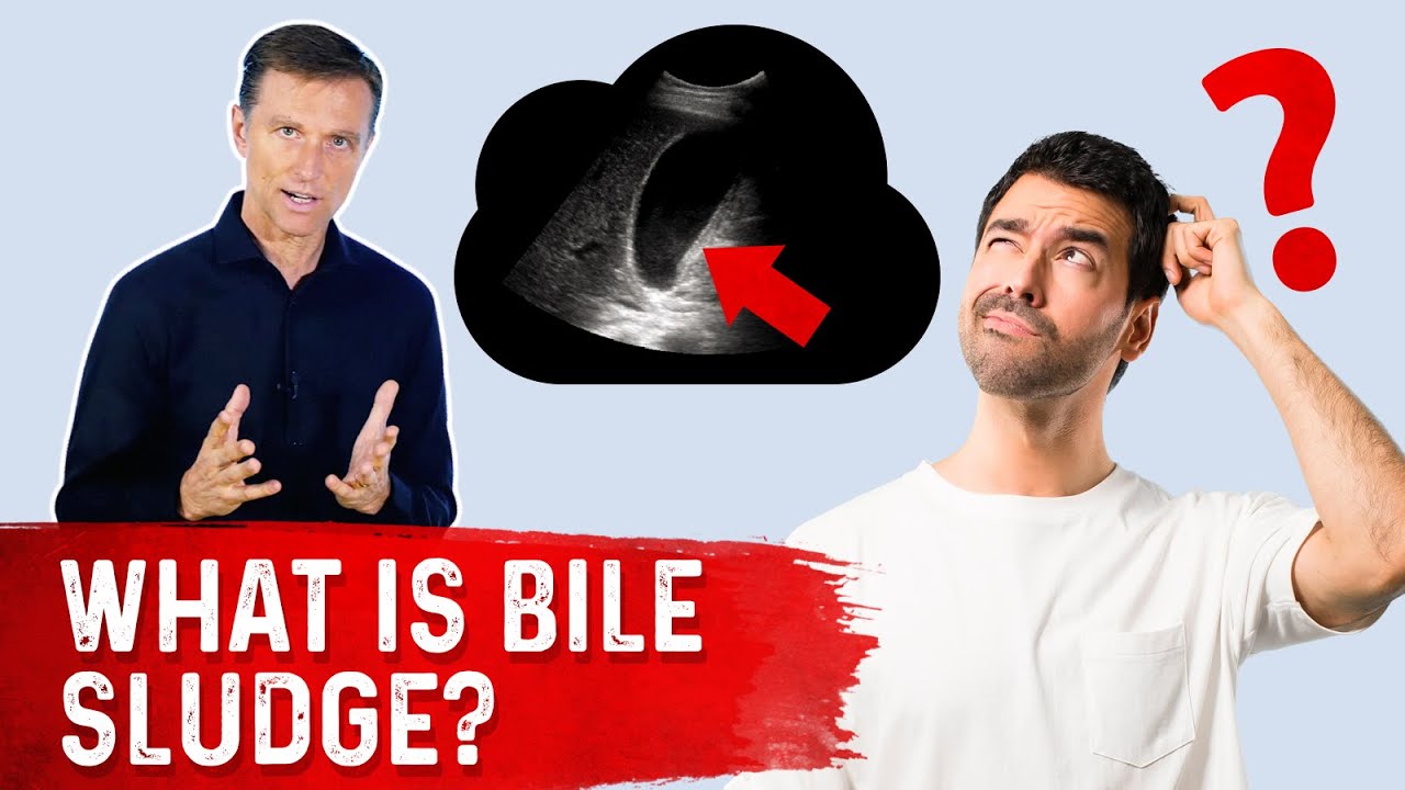 Bile Sludge is a Pre-Gallstone Condition!! &ndash; Bile Sludge Treatment Covered by Dr. Berg