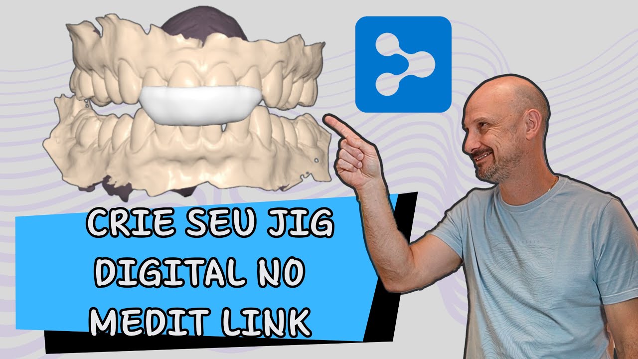 JIG Anterior Digital no Medit Link: Como Criar, Exportar e Usar com Precisão Máxima na Clínica!
