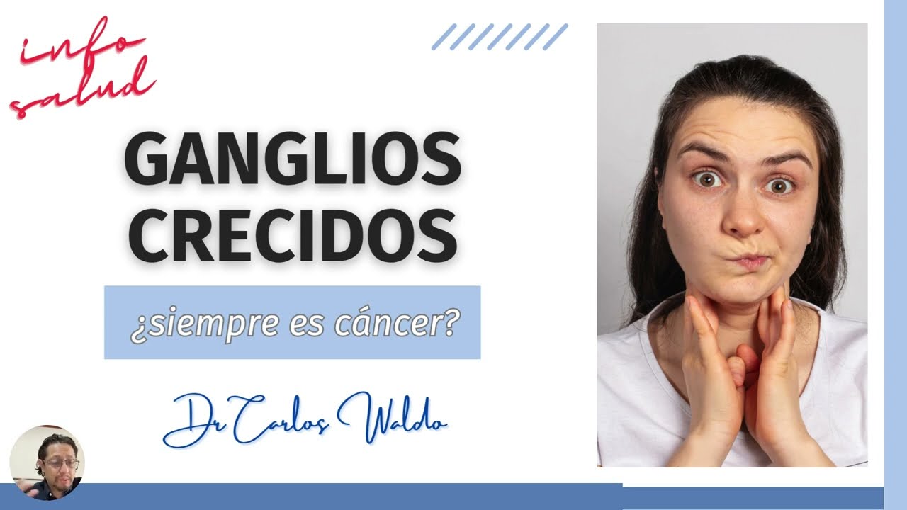Ganglios crecidos  ¿Siempre es cancer?