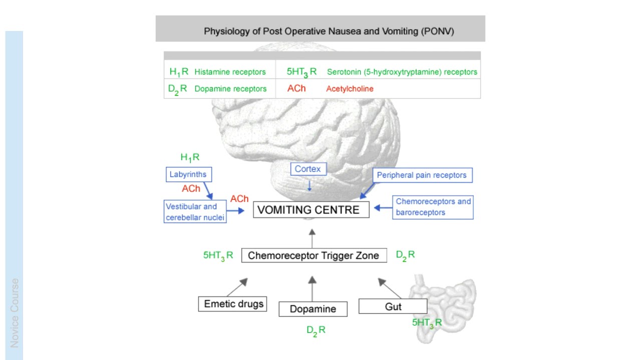 Post Operative Nausea and Vomiting (PONV) | Anaesthesia