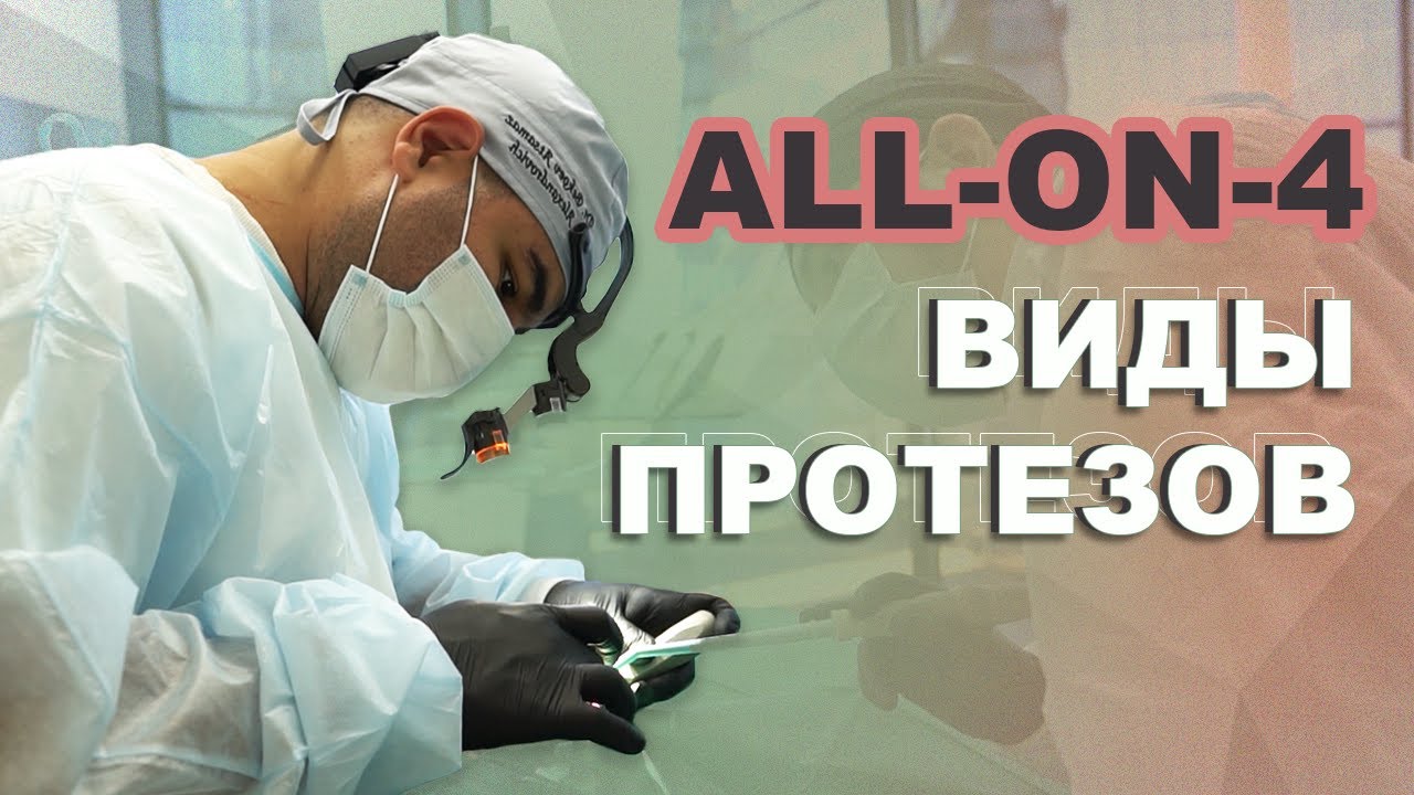 Виды протезов ALL ON 4. Какой выбрать? Бекоев Ацамаз