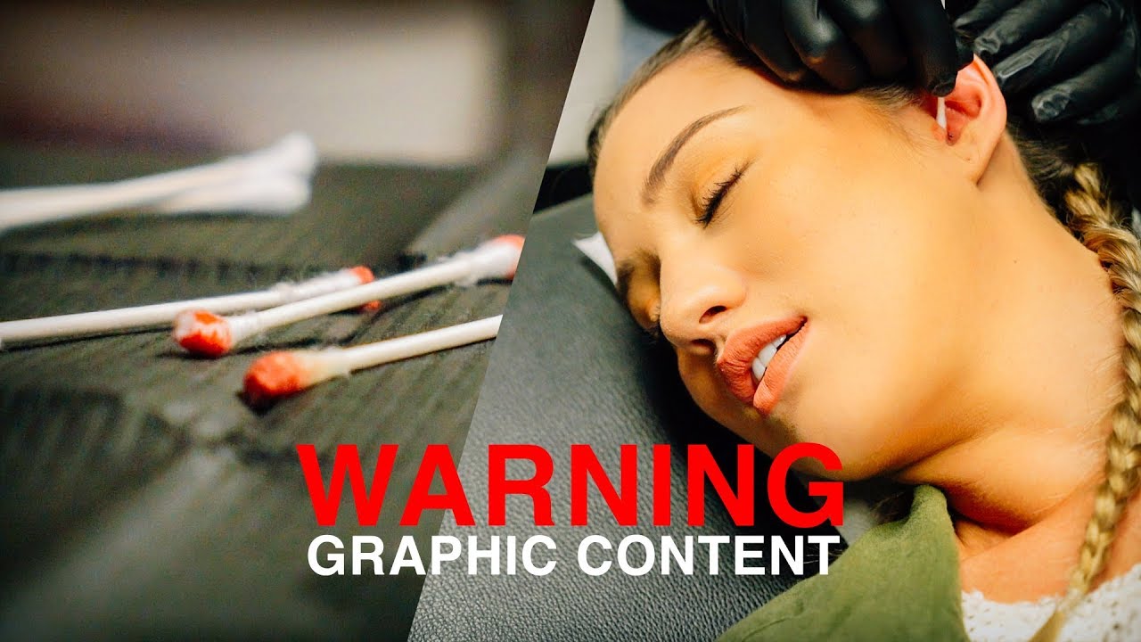 WARNING! GRAPHIC CONTENT // The Migraine Daith Piercing | Vlog