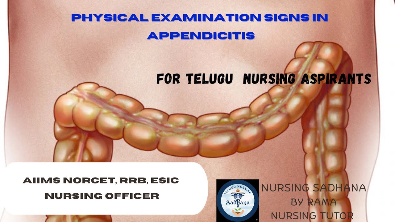 Physical examination signs in APPENDICITIS