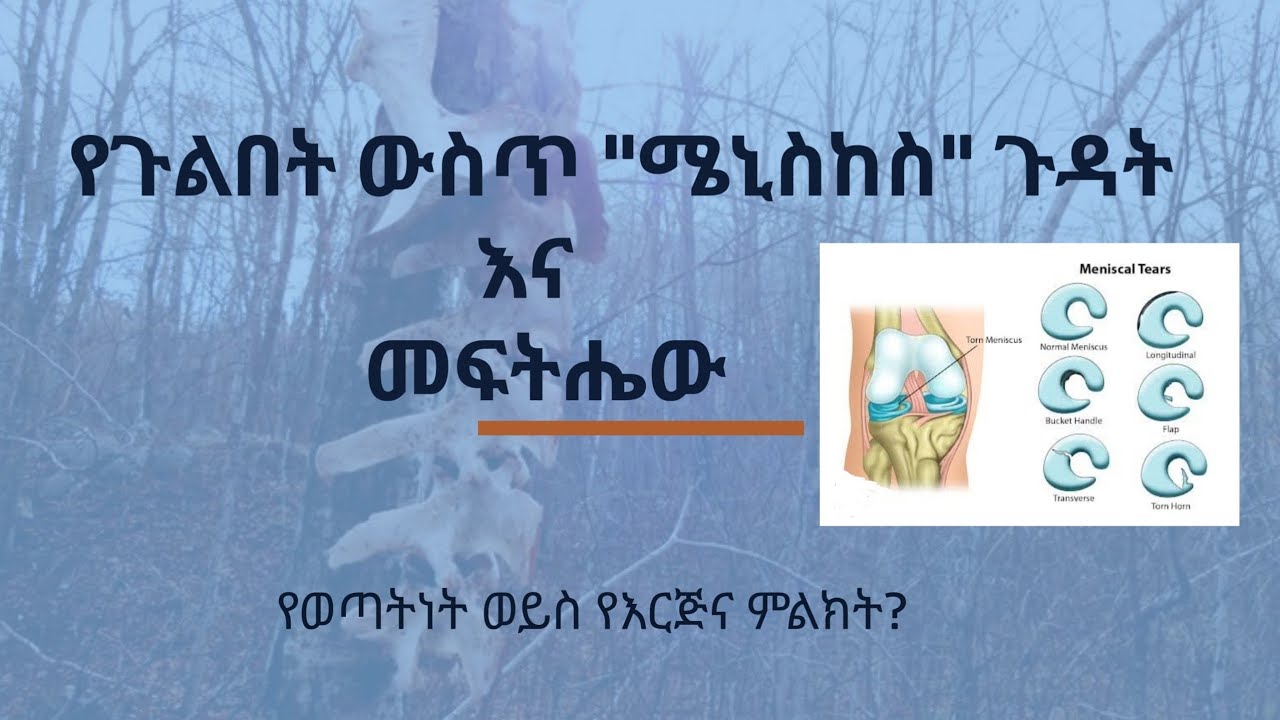 የጉልበት ውስጥ ሜኒስከስ ጉዳት የእርጅና ወይስ የወጣትነት ምልክት?