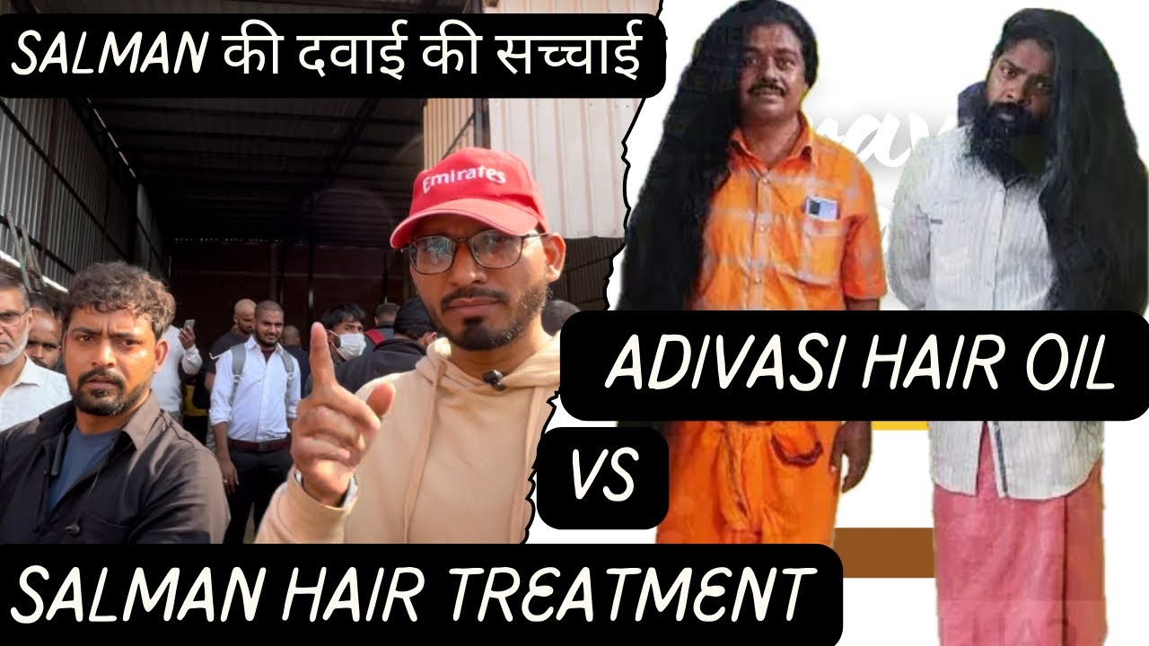 Salman Hair Treatment vs Adivasi Hair Oil I बालों की समस्या का हल I salman mandoli chungi #hair