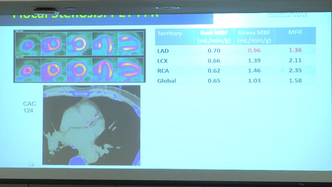 1.13.26 Multi-Modality Imaging Weekly Webcast