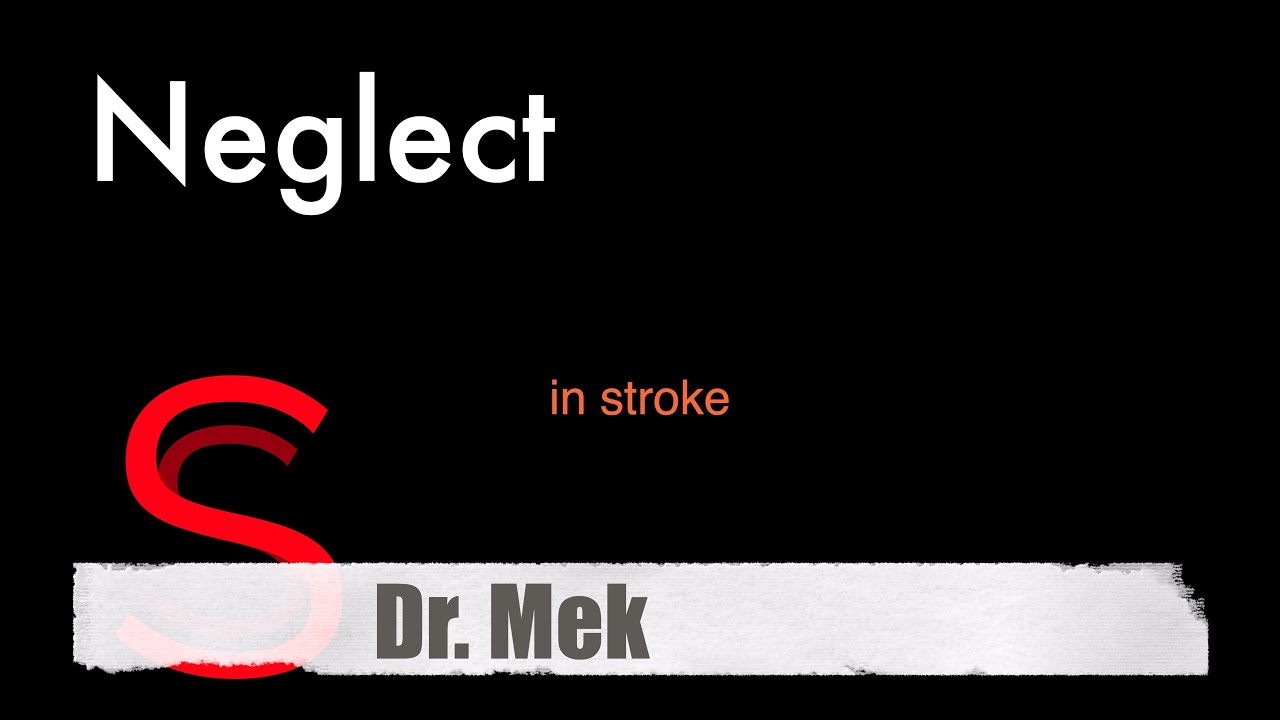 Strike Stroke with Dr.Mek: Left Sided Neglect (E16)