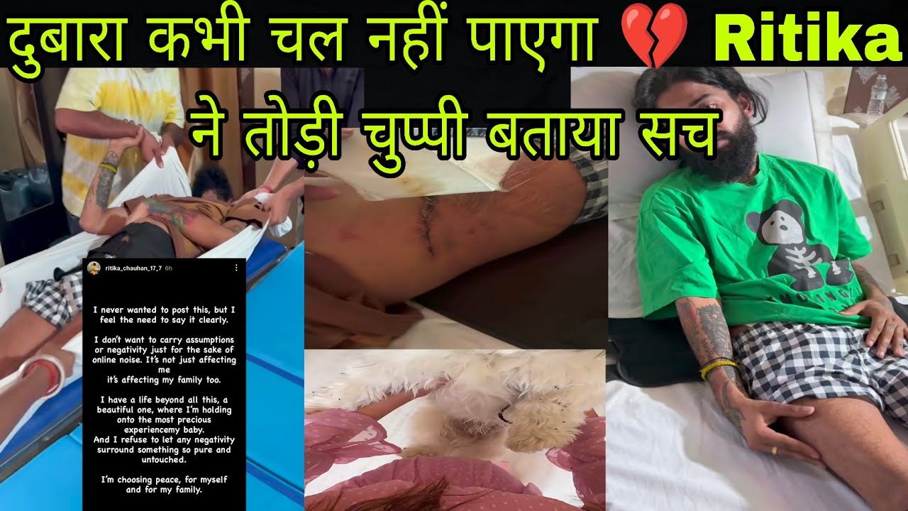 @TheUK07Rider Anurag Dobhal के लिए बुरी खबर 😱 नही चल पाएगी कभी ❓Wife Ritika ने भी छोड़ा साथ ❓