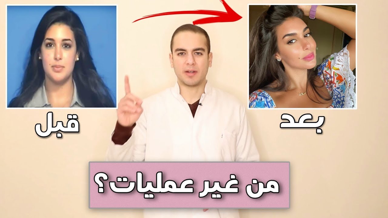 دكتور يوضح : هل خضعت ياسمين صبري لعمليات تجميل؟