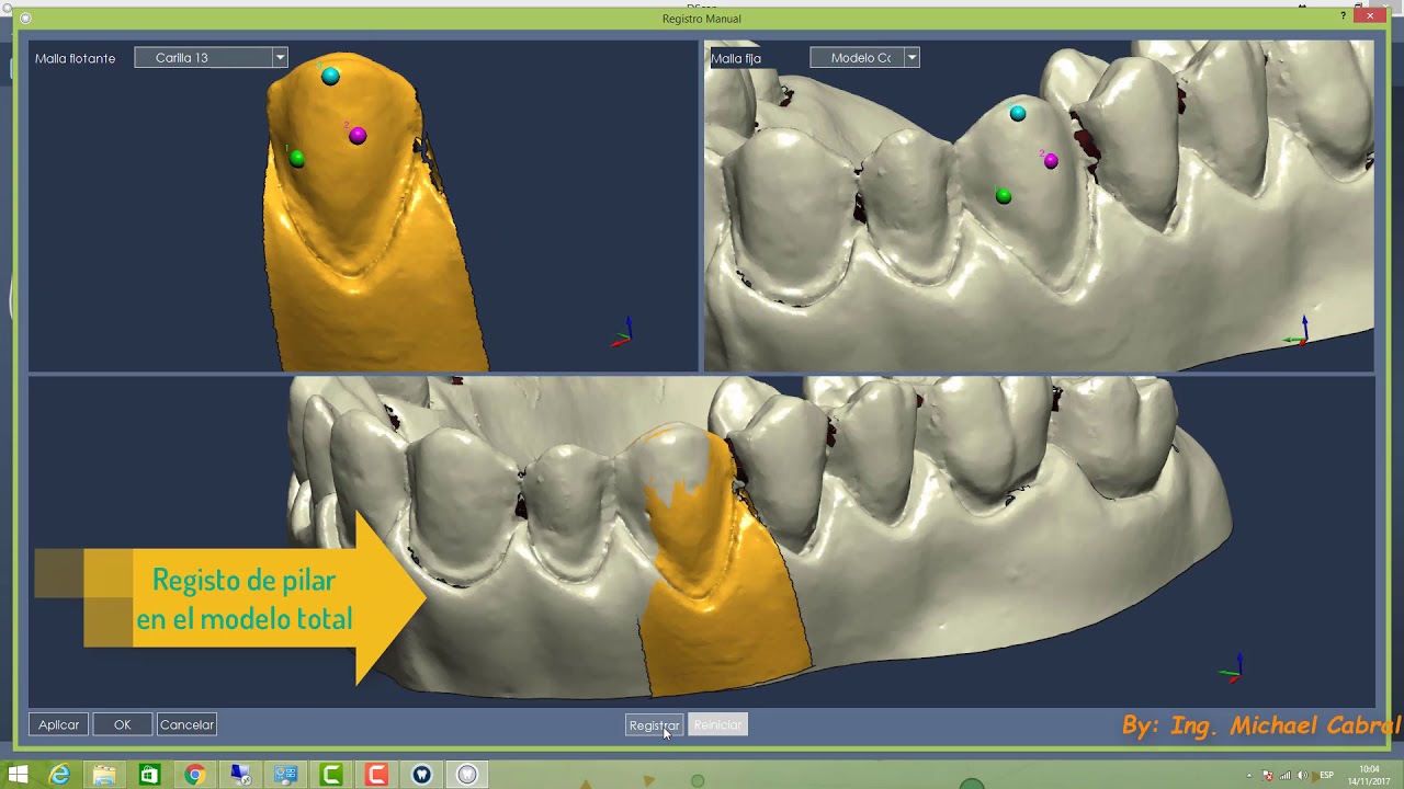 DentalCad 6   Dise&ntilde;o de Carillas