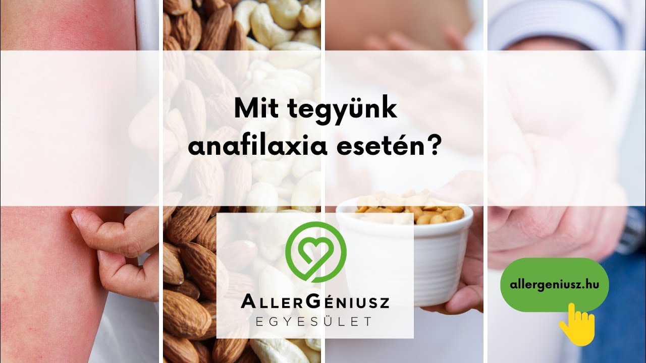 Mit tegy&uuml;nk anafilaxia eset&eacute;n?