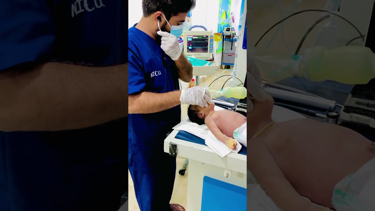 intubation 