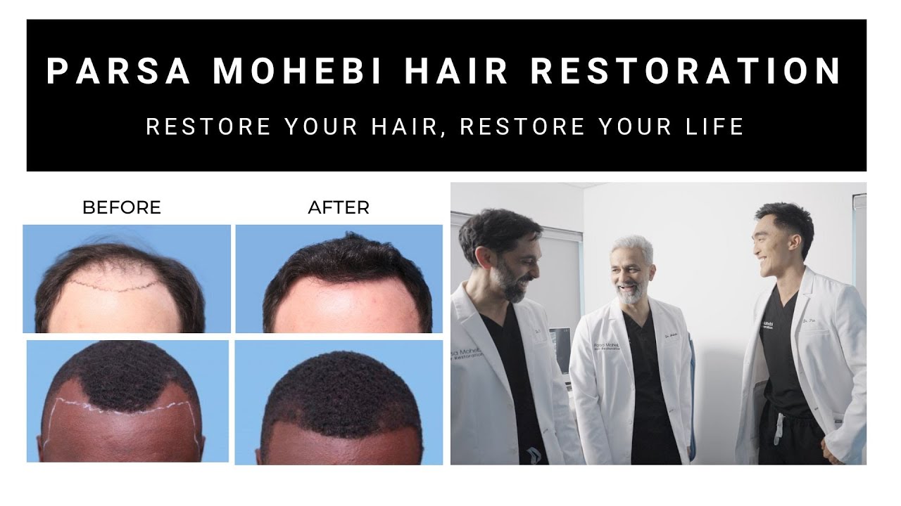 Restore Your Hair at Parsa Mohebi Hair Restoration (LA/SF)