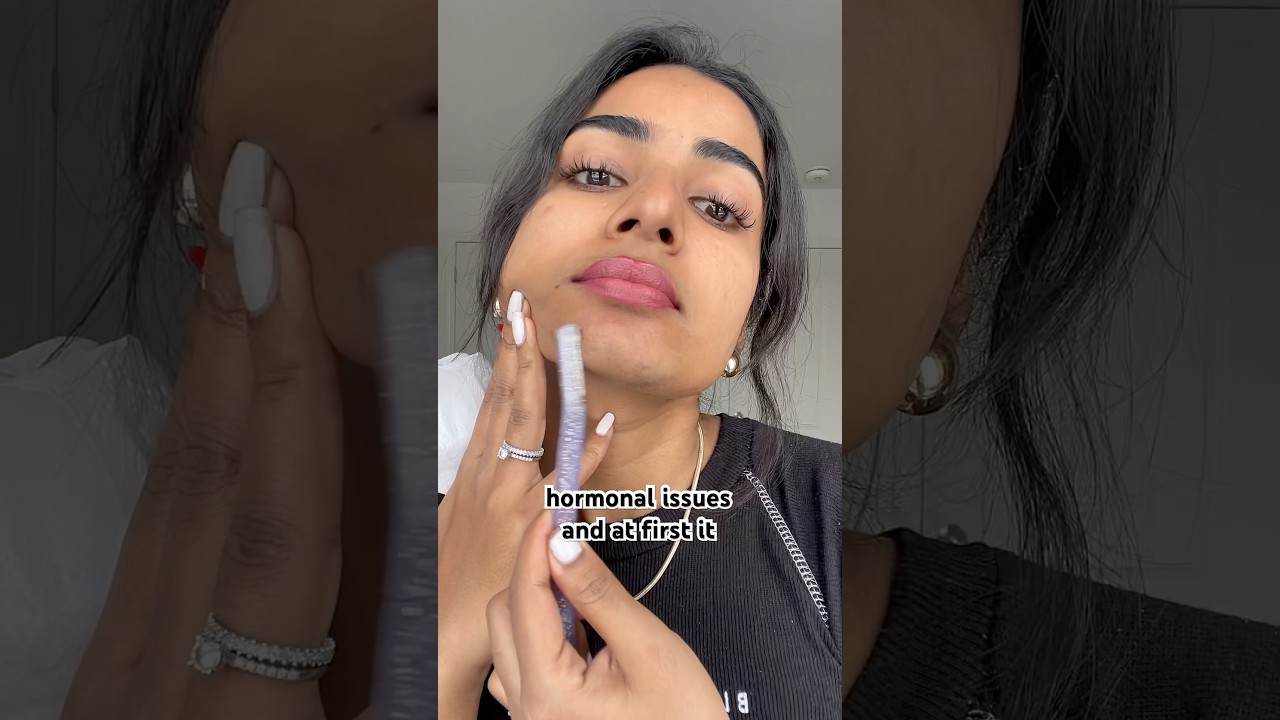 У меня растут ГУСТЫЕ волосы на лице из-за гормональных проблем 🥺