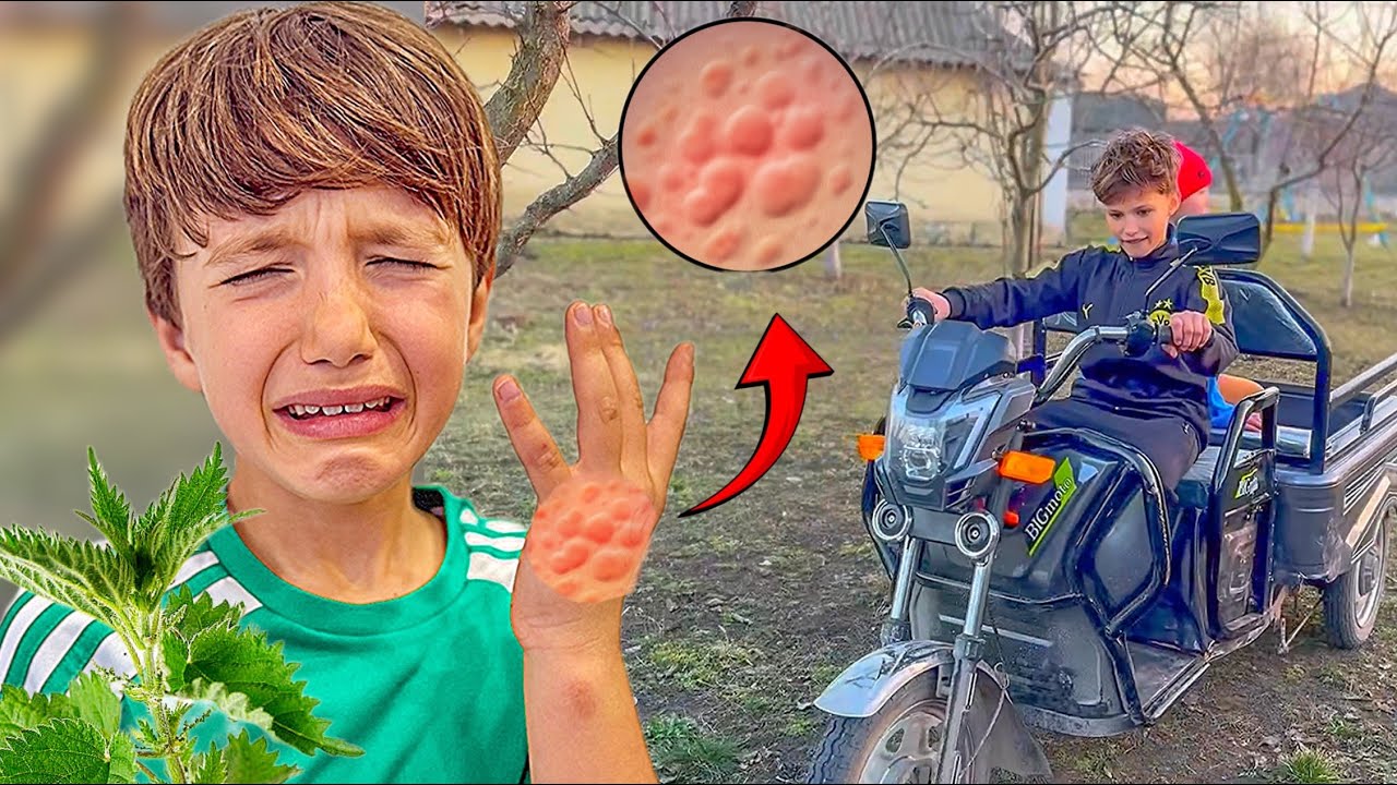 Ernest ÎNȚEPAT de URZICĂ😱/ Cum am AJUNS acasă?😳