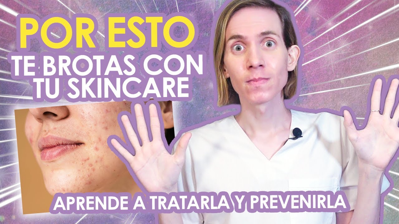 PURGA: POR ESTO te BROTAS AL USAR tus PRODUCTOS DE SKINCARE -  ¿Qué es y cómo tratarla?