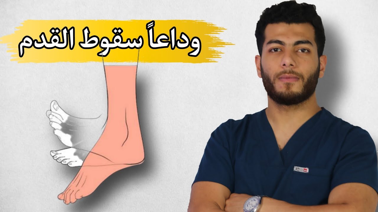 ٥ تمارين فقط لعلاج سقوط القدم |سقوط القدم والانزلاق الغضروفي