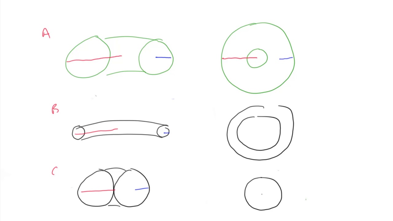 2-8 Introduction to Toric Lenses