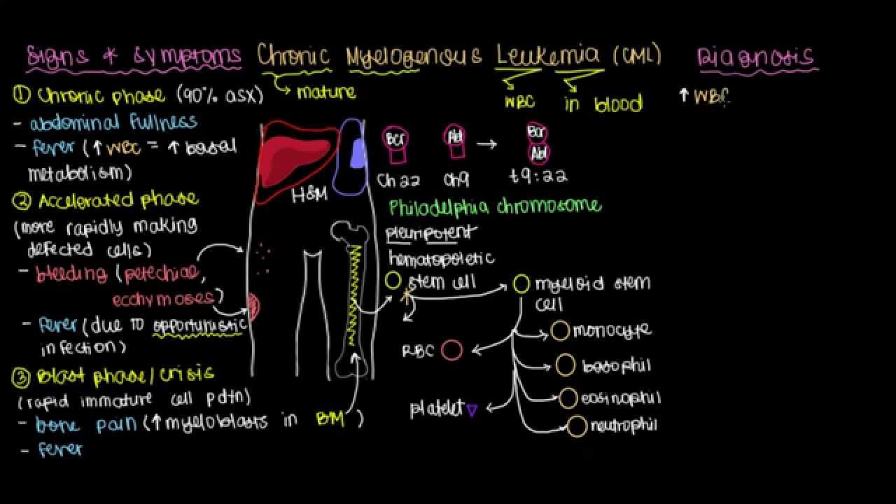 What is chronic myelogenous leukemia?