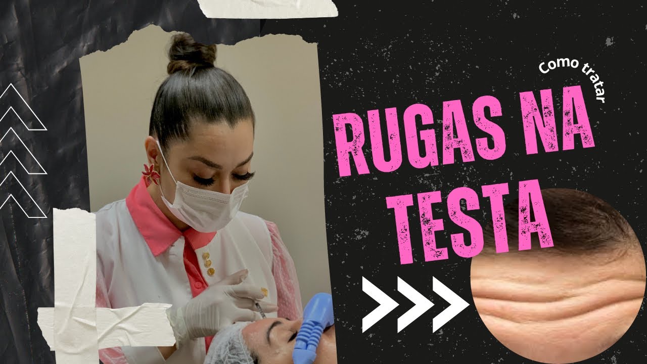 Tratamentos estéticos para rugas na testa (30+)