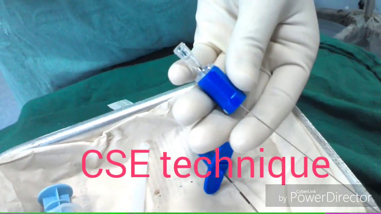 Combined spinal-epidural anaesthesia