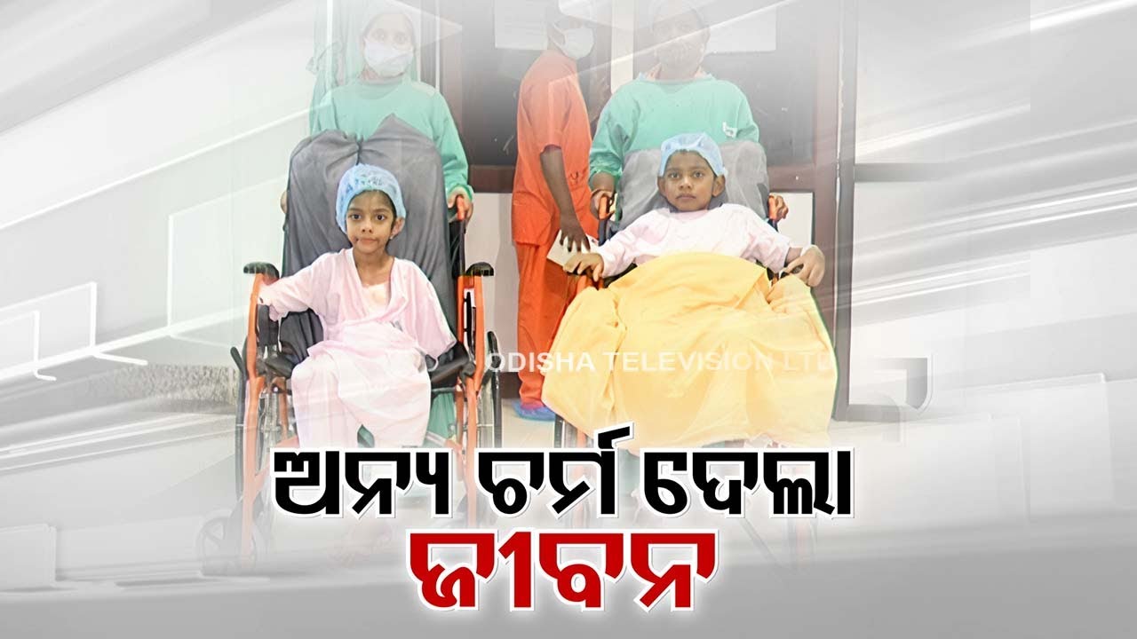 Allogeneic transplant in Bhubaneswar AIIMS saves 2 kids with burn injuries
