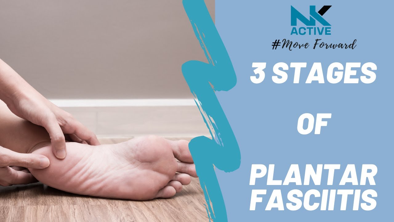 Plantar fasciitis - 3 possible stages