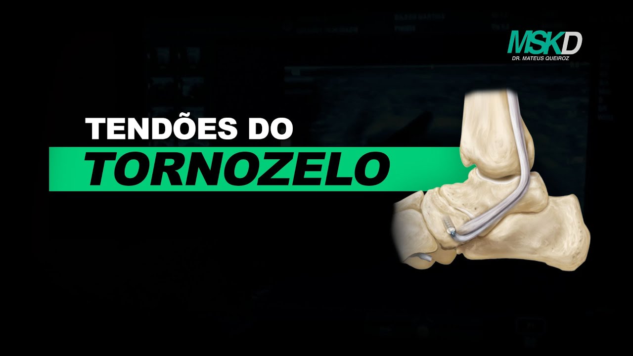 PRÁTICA NO APARELHO - Tendões do tornozelo