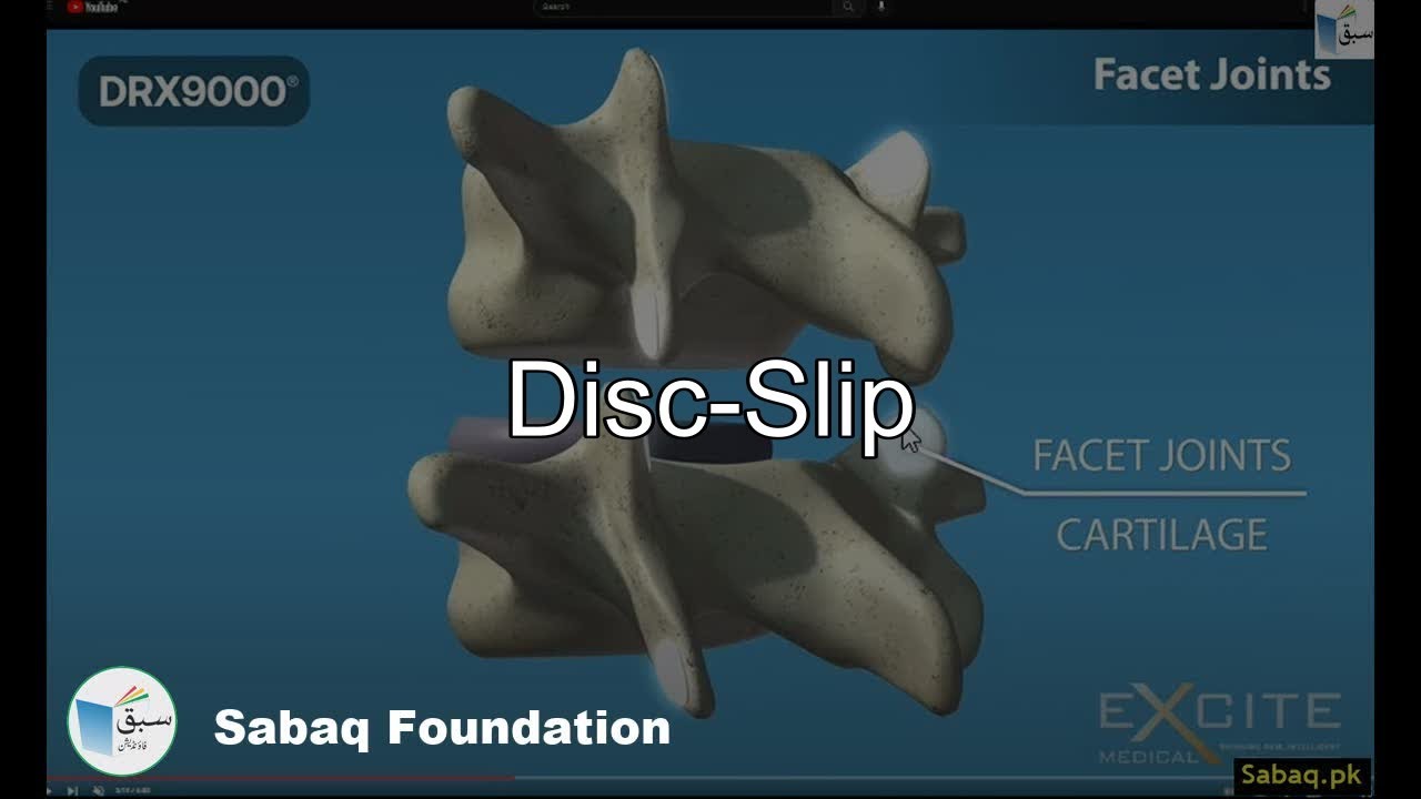 Disc-Slip, Biology Lecture | Sabaq.pk