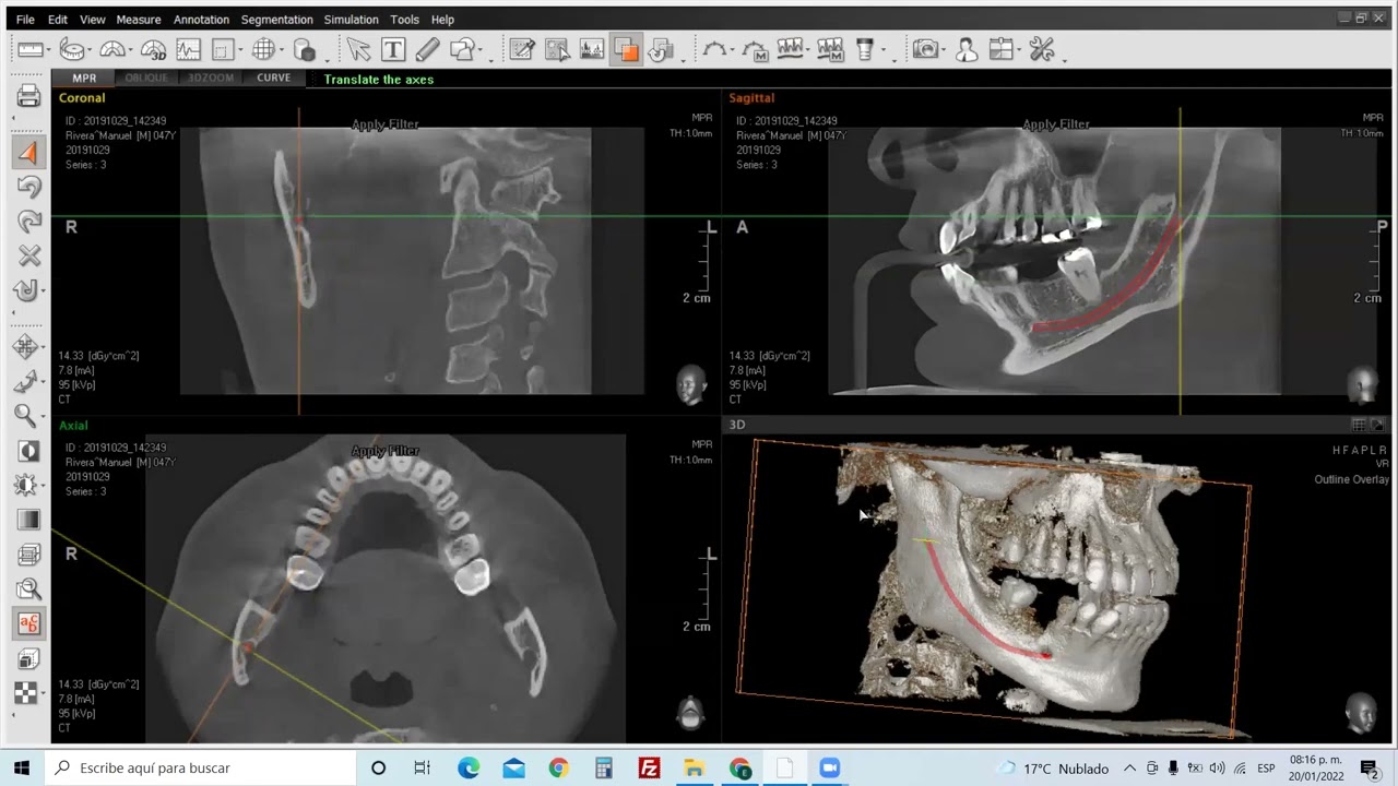 3er Webinar dental 