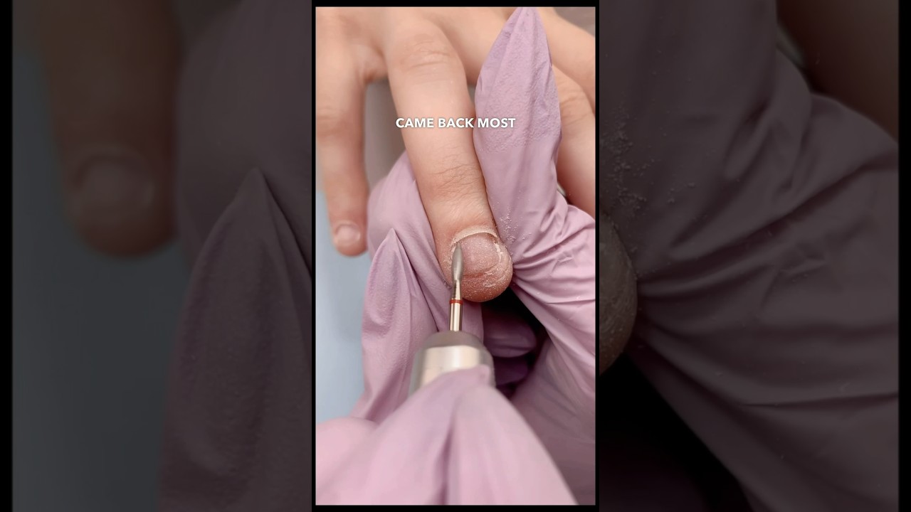 How to Grow Bitten Nails 💅