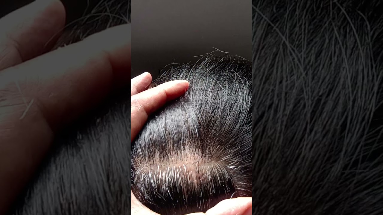 most satisfying White hair removal 0.52 #stressremoval #satisfying #relaxing