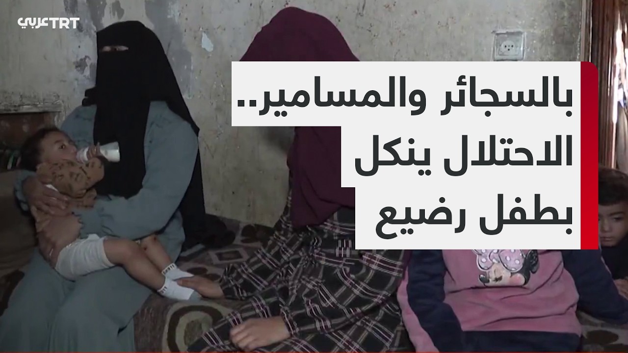 TRT عربي تلتقي والدة الرضيع جواد أبو نصار الذي تعرض للتعذيب والتنكيل من جنود الاحتلال