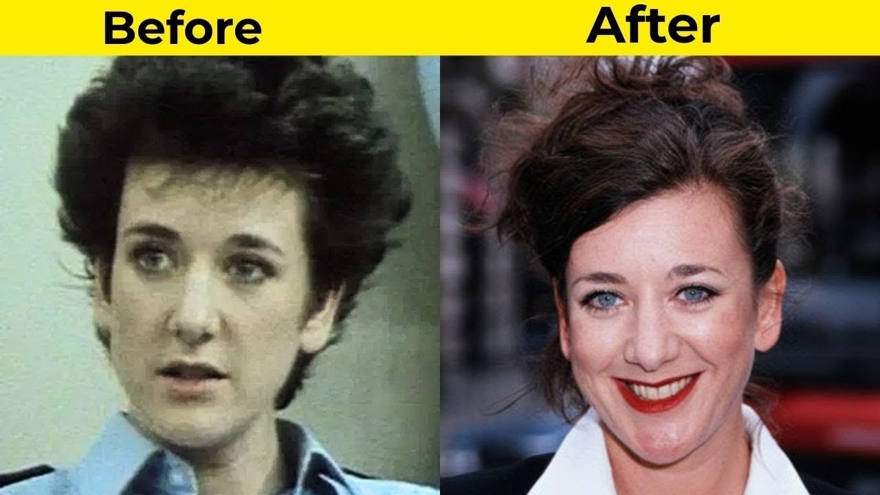 London's Burning Cast - Before & After Faces