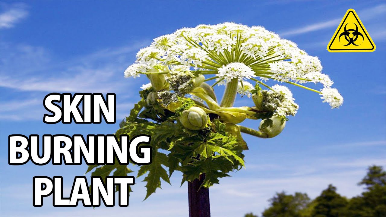 This Plant Will Melt Your Skin (CampAesthetics Extra)