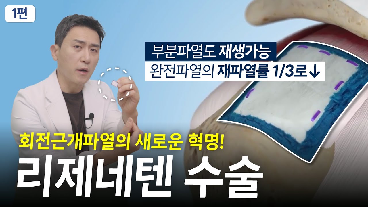 어깨 회전근개파열의 새로운 혁신 패치봉합술(리제네텐) 재생은 물론 재파열을 1/3로⁉️ㅣ210정형외과 최준하 대표원장