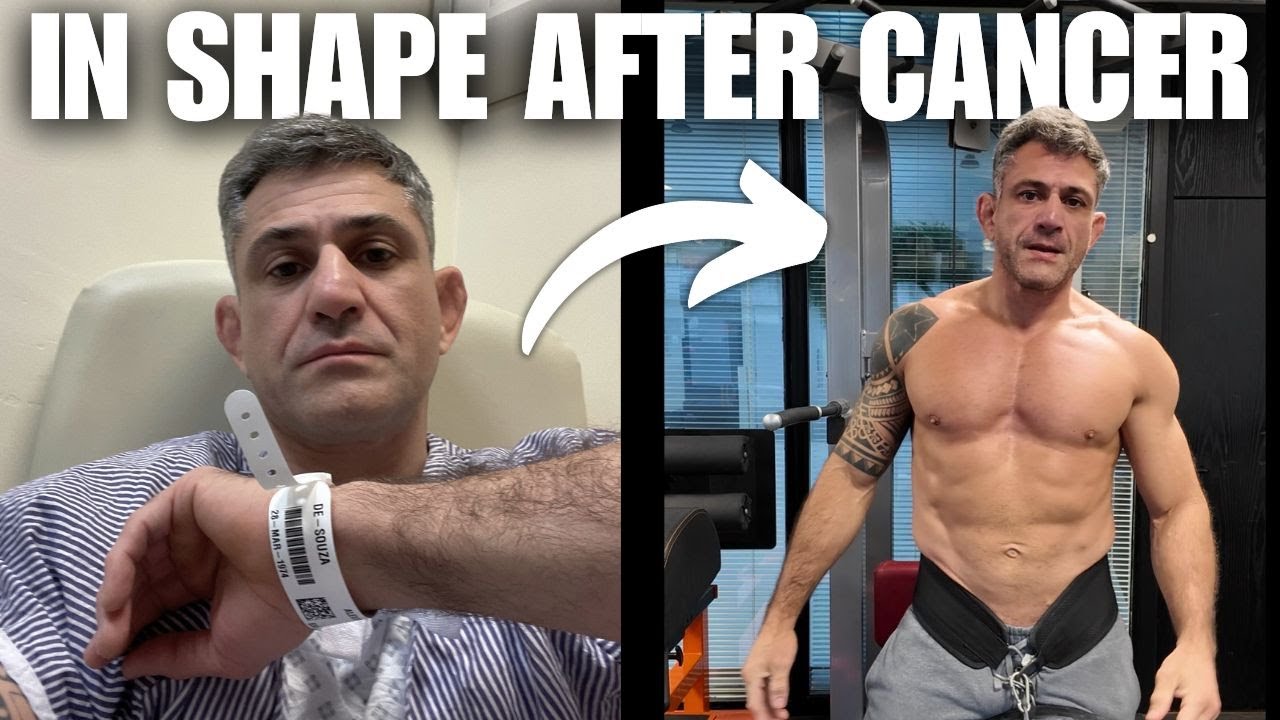 How to get in shape after Prostate Cancer Surgery