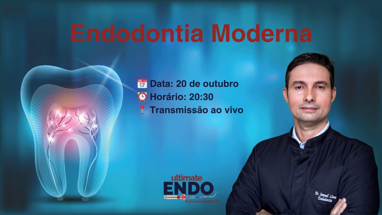 ENDODONTIA MODERNA :: Aula Ao Vivo - 20/10 - 20:30