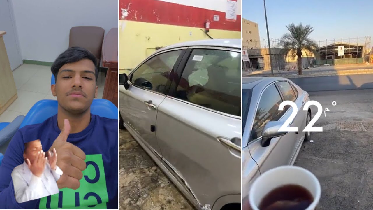 سناب دركالو ❤️(غسل السيارة🚙وطبيب الاسنان👨‍💼)
