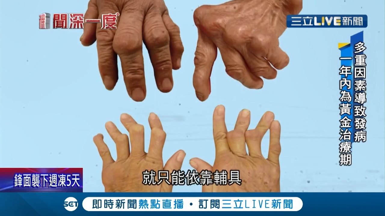 全球首發現！