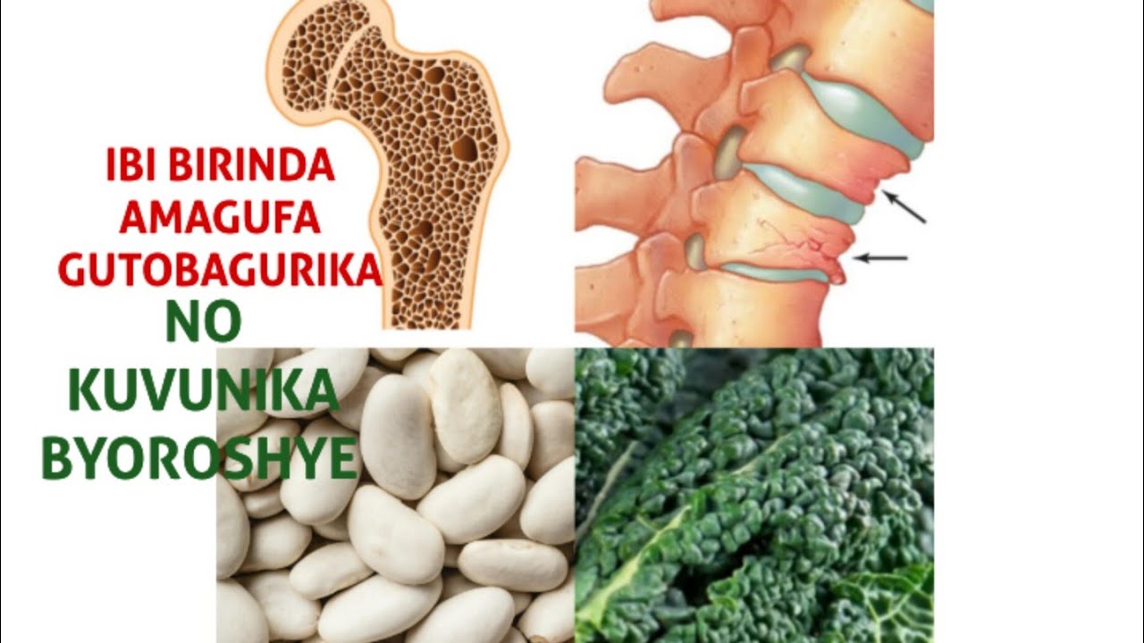 IBIRIBWA 5 UTAJYA URYA BIRINDA AMAGUFA KUVUNGAGURIKA/KUVUNIKA BYOROSHYE