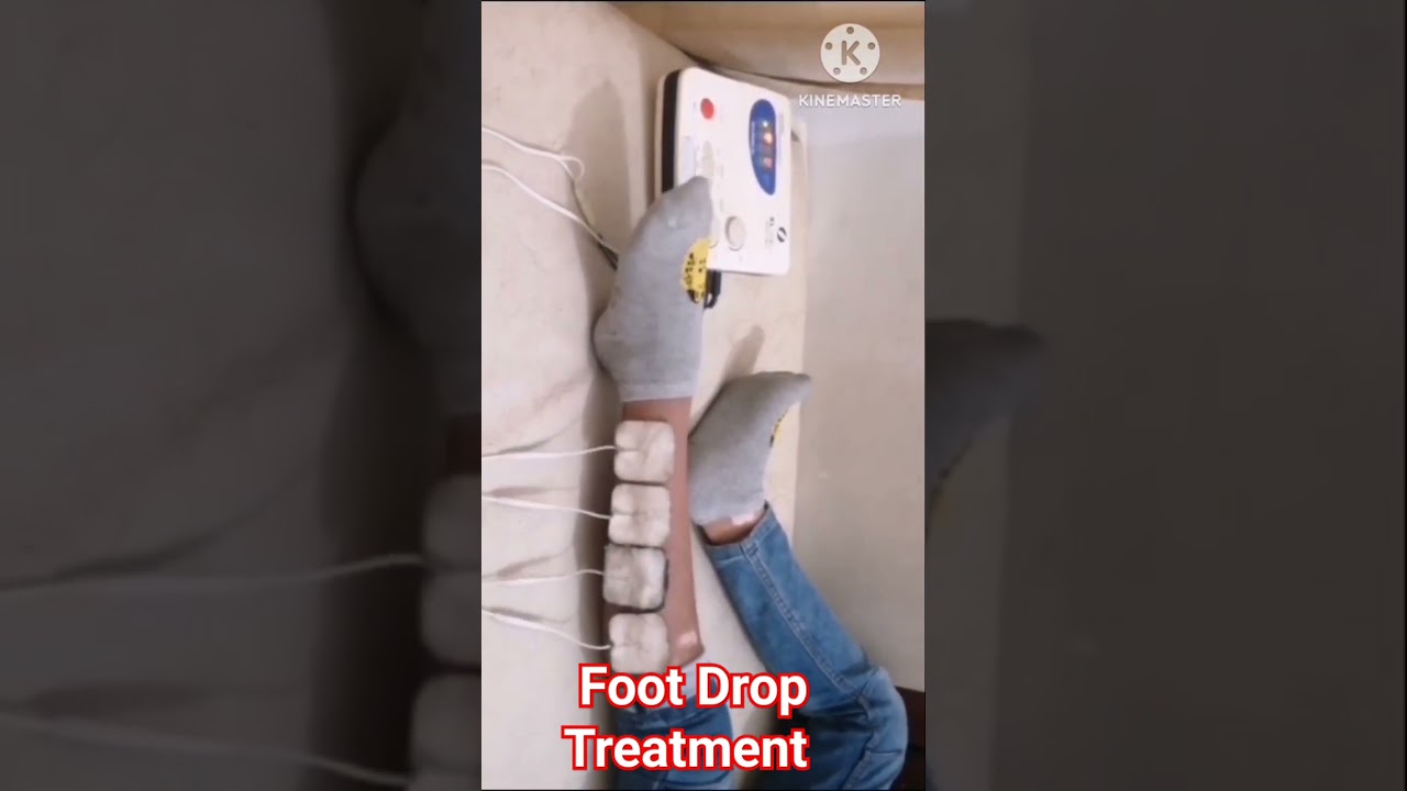 Foot drop Treatment 