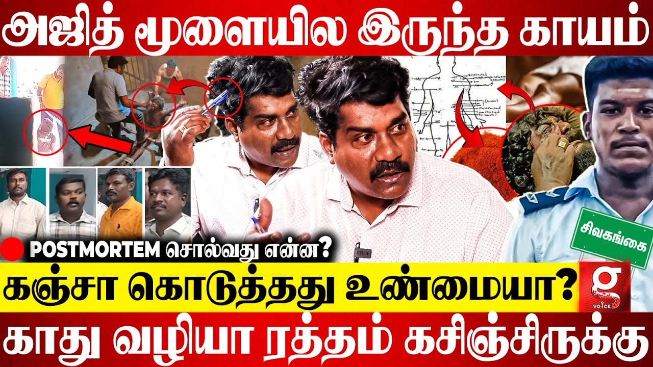 அஜித்குமார் POSTMORTEM REPORT-ல் அதிரடி திருப்பம்😱கடைசி நேரத்தில் வெளியான பகீர்😲Dr. Dekkal Explains