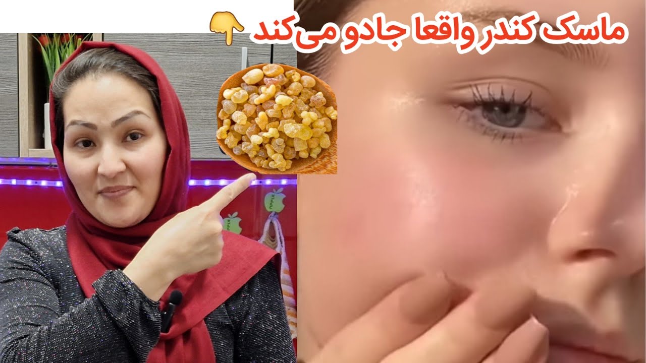 ماسک کندر که جوان کننده پوست صورت است .و ضد جوش ✅️
