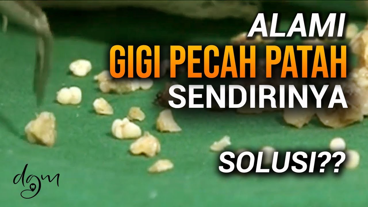 Mengatasi Gigi Pecah Sendirinya